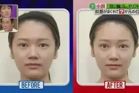 转发收藏|让脸变大的4个生活习惯，脸部按摩就能变小！图片