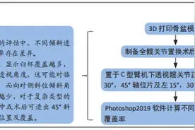 不同透视角度下髋臼杯覆盖率：评估复杂类型髋关节发育不良全髋关节置换假体的位置图片
