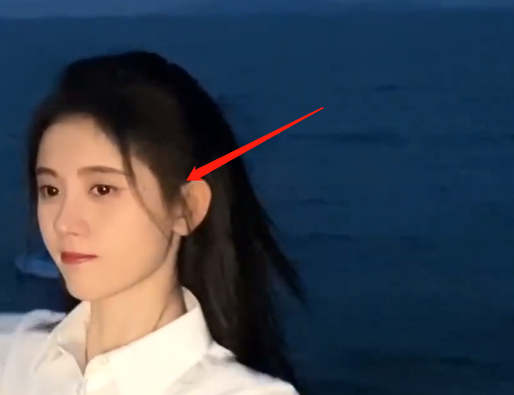 耳朵前鬓角下鸡皮疙瘩红印