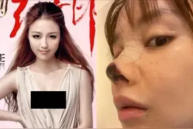 明明已经挺漂亮，却非要折腾脸的7大女星图片