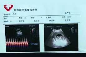女精神病人与护工“自愿”发生关系怀孕，丈夫：生下孩子当证据视频封面