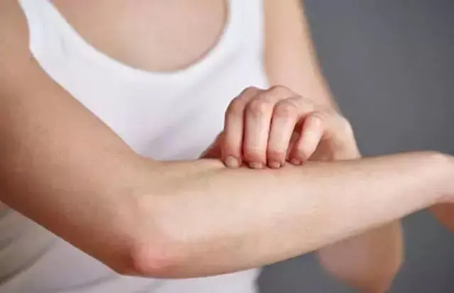 鸡皮肤的专业名字叫什么