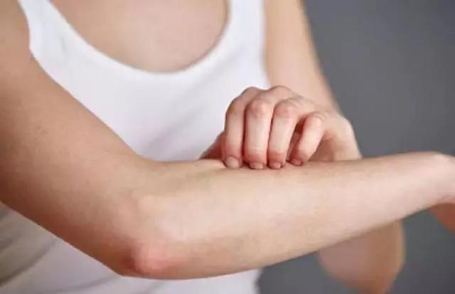 去旅游了后皮肤有鸡皮 去旅游了后皮肤有鸡皮