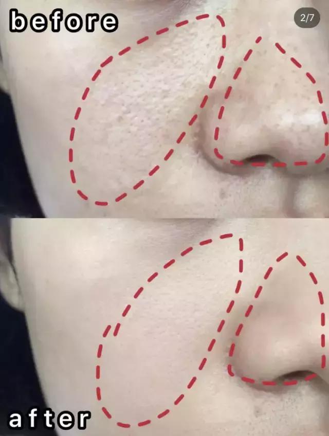 直播洗脸竟成了明星抢流量的绝招！氨基酸泡泡洁面，素颜更自信