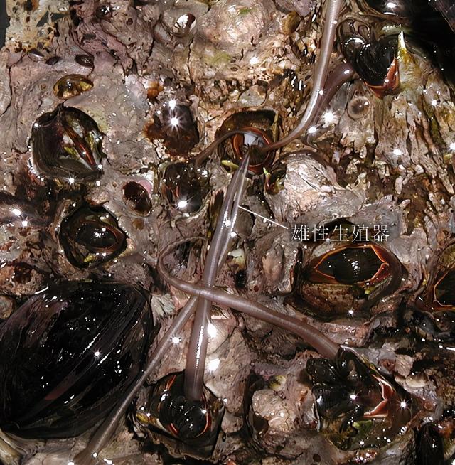 龟头里面有鸡皮疙瘩