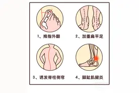 宝宝3岁前穿这种鞋会导致脊柱侧弯，快看看你家有没有？图片