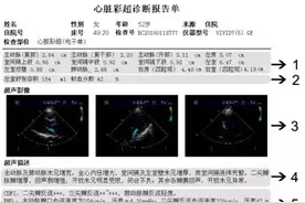 超实用！7 步教你读懂超声心动图…图片