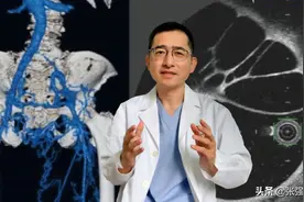 世界血栓日｜深静脉血栓后遗症：一种被严重忽略的血管疾病图片