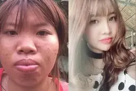 越南凤姐为了嫁入豪门，砸10万整容成美女嫁给富二代，她现状如何图片