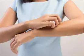 痒是什么？为什么挠痒痒的时候会觉得很爽，越挠越停不下来？图片