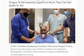 罕见新冠肺炎后遗症“巨舌症”，舌头肿大到嘴巴放不下，需手术图片