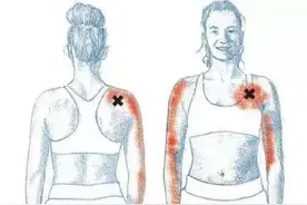 如何消灭蝴蝶臂呢？图片