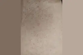 皮肤痒，起疹子，求大神治疗方法图片