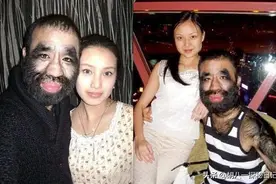 于震寰：出生一身长毛，与10位护士相亲被拒，42岁终娶90后娇妻图片