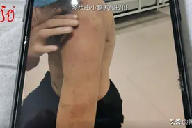 学校寝室内引发争斗，受伤学生至今未归校园图片