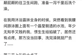 一个月不洗头会怎么样？图片