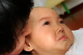 1岁小孩竟还不会爬行，医院检查后说出原因，夫妻听此都后悔不已图片