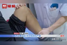 一男子日常运动量过大，结果腿部变形了图片