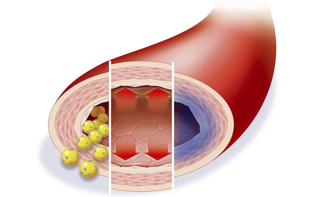 娆ｆ瘮鍏嬫湰缁磋帿寰凤紝閾跺睉鐥呮偅鑰呯殑鍏ㄦ柊鐢ㄨ嵂閫夋嫨锛熶娇鐢ㄦ湡闂村彲浠ユ场婢″悧