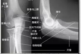 详细的肘关节X线解剖+摄影技巧+骨骺时间+测量方法图片