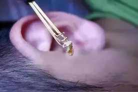 妈妈是否要给孩子掏“耳屎”？按照年龄来，错误的做法会伤到孩子图片