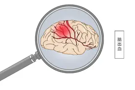 男子深夜突发脑溢血离世，脑出血发生后，患者家属该如何急救？图片