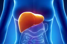 肝硬化患者不能吃哪些食物？5大饮食禁忌要牢记图片