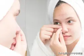 毛孔粗大，黑头多，这种皮肤怎么办呐？图片