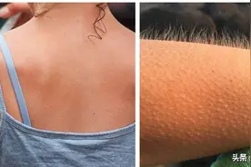 科学解释：我们身体会经历的6种身体反应的科学解释图片