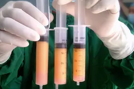 #安心变美课堂##我的安心变美推荐# 自体脂肪填充到哪个部位容易存活？图片