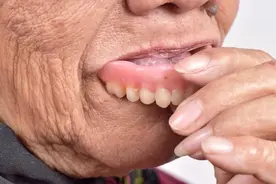 良心老牙医揭晓佩戴假牙的注意事项图片