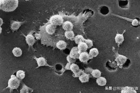 【生物知识】从生物或者医学角度告诉你人为什么会死亡图片