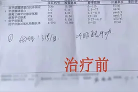 为什么甲亢治成了甲减？只怪当初选错了治疗方法？图片