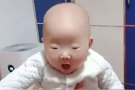 “眼睛最小宝宝”走红，妈妈担心看不见路，网友：李荣浩甘拜下风图片