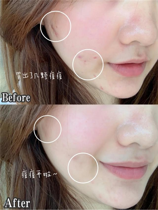 瞎洗脸，毁了多少女人的好皮肤！这种正确的洗脸方式你需要知道