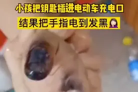 可怕！孩子将钥匙插进电动车充电口，手指瞬间被电到发黑图片