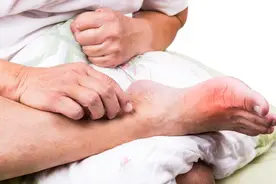 再次提醒：晚上睡觉时，身体出现3种表现，可能尿酸已“超标”图片