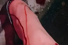 湖北一母亲为保护女儿被咬伤，野狗咬人该找谁赔？路遇恶犬怎么办图片