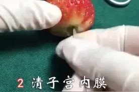 人流对女性伤害有多大？看完这组“草莓”模拟图，夫妻决定避孕图片