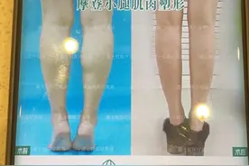 女子被诱导做了小腿阻断术永远无法久站，咨询师称手术没有标准，靠院长经验决定图片
