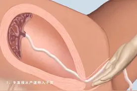 产后“手剥胎盘”有多疼？3D动画还原全过程，当妈真心不易图片