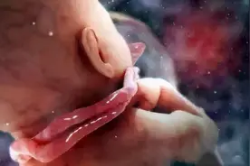 孕期3大“禁忌”动作：孕妈自己很舒服，可胎儿容易“脐带绕颈”图片