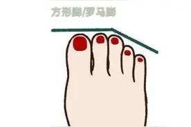 罗马脚 希腊脚 埃及脚 看你什么脚型 学会选择适合自己的鞋型图片
