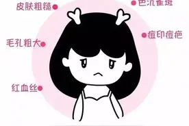 【还你美丽】光子嫩肤，让你遇见更美的自己图片