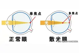 【清晰“视”界】你还在揉眼睛吗？小心了……图片