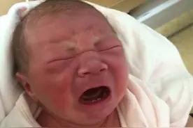 宝宝出生就有两颗“牙齿”，妈妈到处炫耀，医生：你的苦难刚开始图片