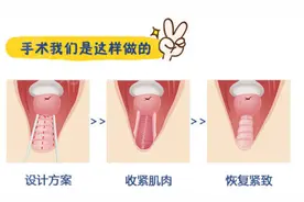 做私密整形手术前，您需要了解这些图片
