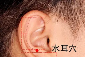 中医健康养生之人体耳部穴位水耳穴图片