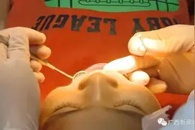 广西5岁女童拔牙大出血脑死亡！医生讲述治疗全过程，家属：将尸检查明真正死因图片