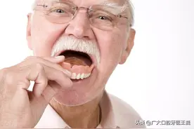 牙槽骨萎缩严重，可以试试这个办法，能够有效恢复一口好牙图片